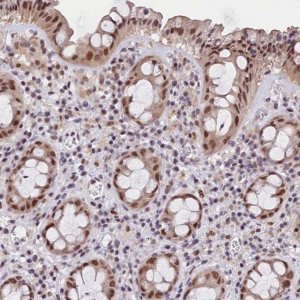 Anti-CDYL2 antibody produced in rabbit 