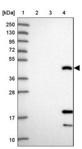 Anti-CEACAM16 antibody produced in rabbit 