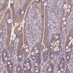 Anti-CEACAM18 antibody produced in rabbit HPA059487-100UL