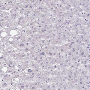 Anti-CEACAM18 antibody produced in rabbit HPA059487-100UL