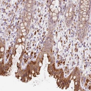 Anti-CEBPZOS antibody produced in rabbit 