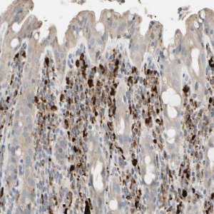 Anti-CECR1 antibody produced in rabbit 