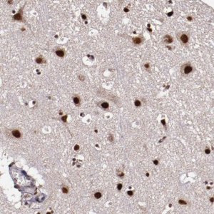 Anti-CECR2 antibody produced in rabbit 