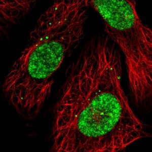 Anti-CECR2 antibody produced in rabbit 