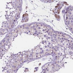 Anti-CECR6 antibody produced in rabbit 