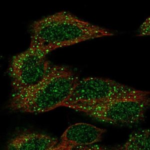 Anti-CECR6 antibody produced in rabbit 