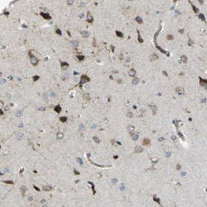 Anti-CELSR2 antibody produced in rabbit 