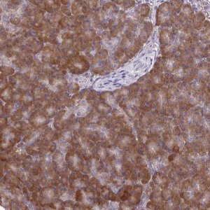 Anti-CEMP1 antibody produced in rabbit 