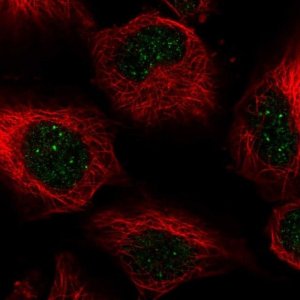 Anti-CENPB antibody produced in rabbit 