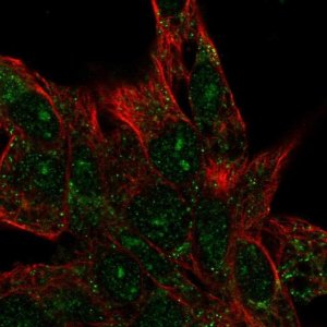 Anti-CENPBD1 antibody produced in rabbit 