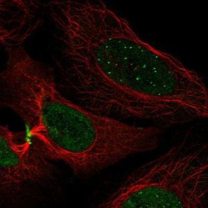 Anti-CENPC antibody produced in rabbit 