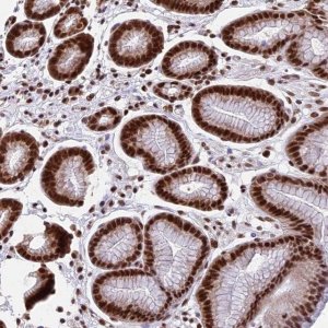 Anti-CENPE antibody produced in rabbit 