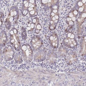 Anti-CENPH antibody produced in rabbit 
