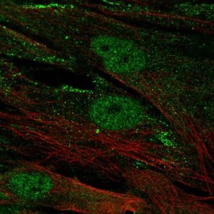 Anti-CENPJ antibody produced in rabbit 