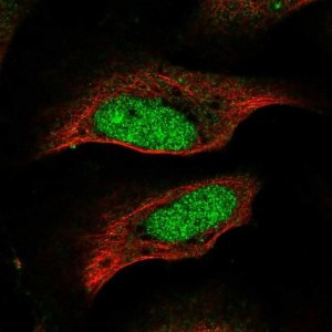 Anti-CENPP antibody produced in rabbit 