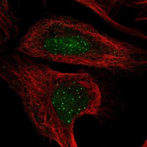 Anti-CENPT antibody produced in rabbit 