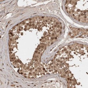 Anti-CENPU antibody produced in rabbit 