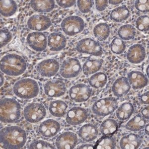 Anti-CEP104 antibody produced in rabbit 