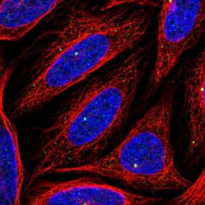 Anti-CEP164 antibody produced in rabbit 