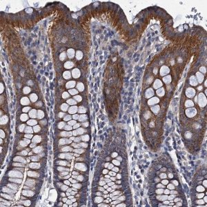 Anti-CEP295 antibody produced in rabbit 