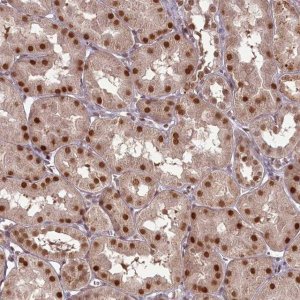 Anti-CEP83 antibody produced in rabbit 