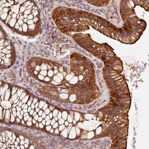 Anti-CEP95 antibody produced in rabbit 