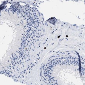 Anti-CER1 antibody produced in rabbit HPA019917-100UL