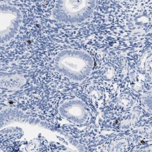 Anti-CER1 antibody produced in rabbit HPA019917-100UL