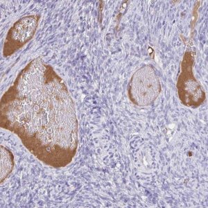 Anti-CFH antibody produced in rabbit HPA053326-100UL