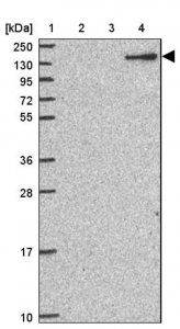 Anti-CFH antibody produced in rabbit HPA053326-100UL