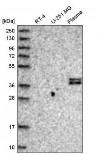 Anti-CFHR1 antibody produced in rabbit HPA038915-100UL