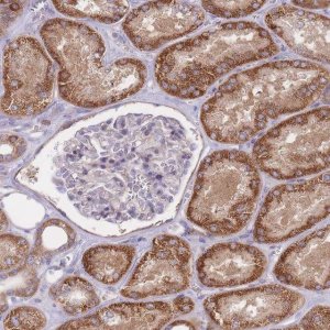 Anti-CHAC1 antibody produced in rabbit 