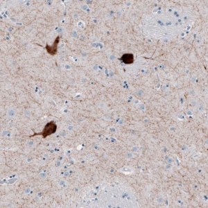 Anti-CHAT antibody produced in rabbit 