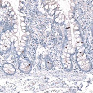 Anti-CHAT antibody produced in rabbit 