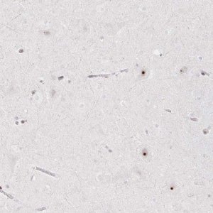 Anti-CHD2 antibody produced in rabbit 