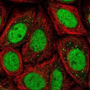 Anti-CHD2 antibody produced in rabbit 