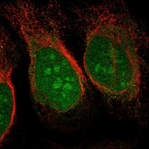 Anti-CHD3 antibody produced in rabbit 