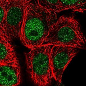Anti-CHEK1 antibody produced in rabbit 