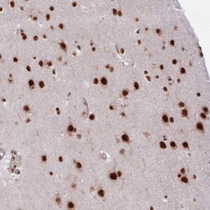 Anti-CHERP antibody produced in rabbit 