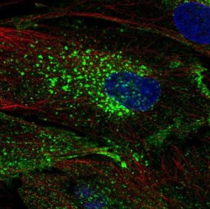 Anti-CHIC2 antibody produced in rabbit 