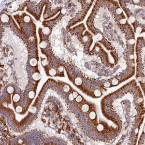 Anti-CHID1 antibody produced in rabbit HPA039374-100UL