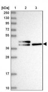 Anti-CHID1 antibody produced in rabbit HPA039374-100UL
