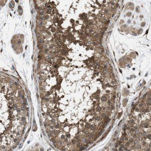 Anti-CHKB antibody produced in rabbit 
