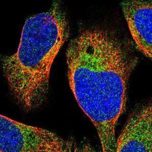 Anti-CHKB antibody produced in rabbit 