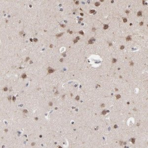 Anti-CHM antibody produced in rabbit 