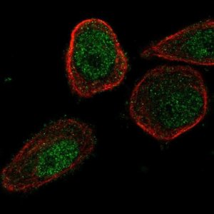 Anti-CHML antibody produced in rabbit 