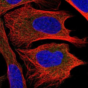 Anti-CHMP2B antibody produced in rabbit 