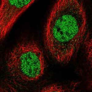 Anti-CHRAC1 antibody produced in rabbit 