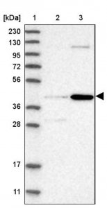 Anti-CHRDL2 antibody produced in rabbit 