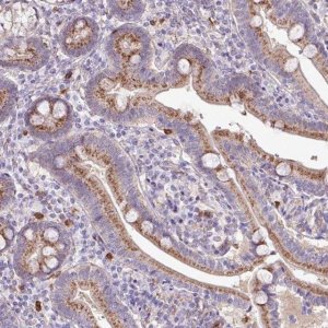 Anti-CHST11 antibody produced in rabbit 